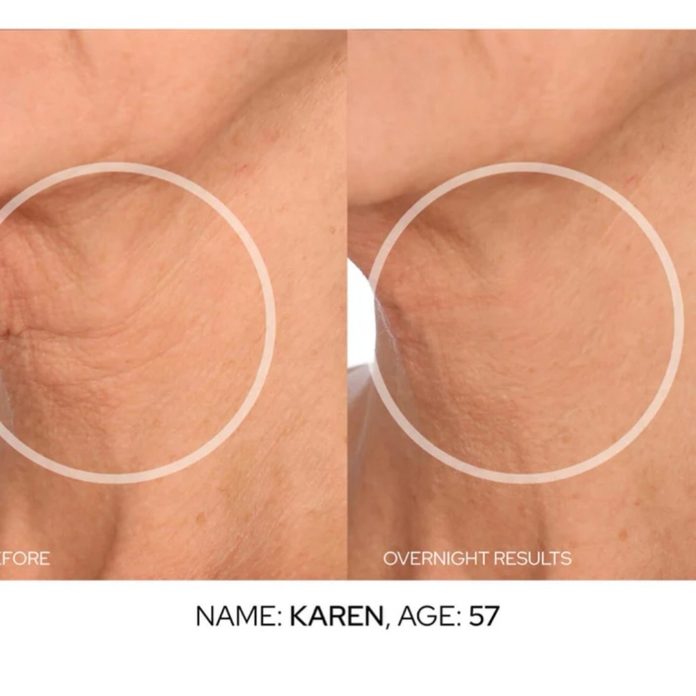 SiO Facelift Pack Reusable Patches